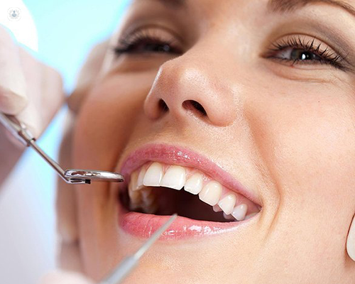 Dental Implants in Tampa: A Comprehensive Guide to Restoring Your Smile post thumbnail image